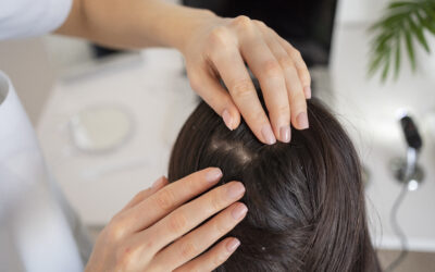 Does Hard Water Cause Dandruff? Here’s What You Need to Know